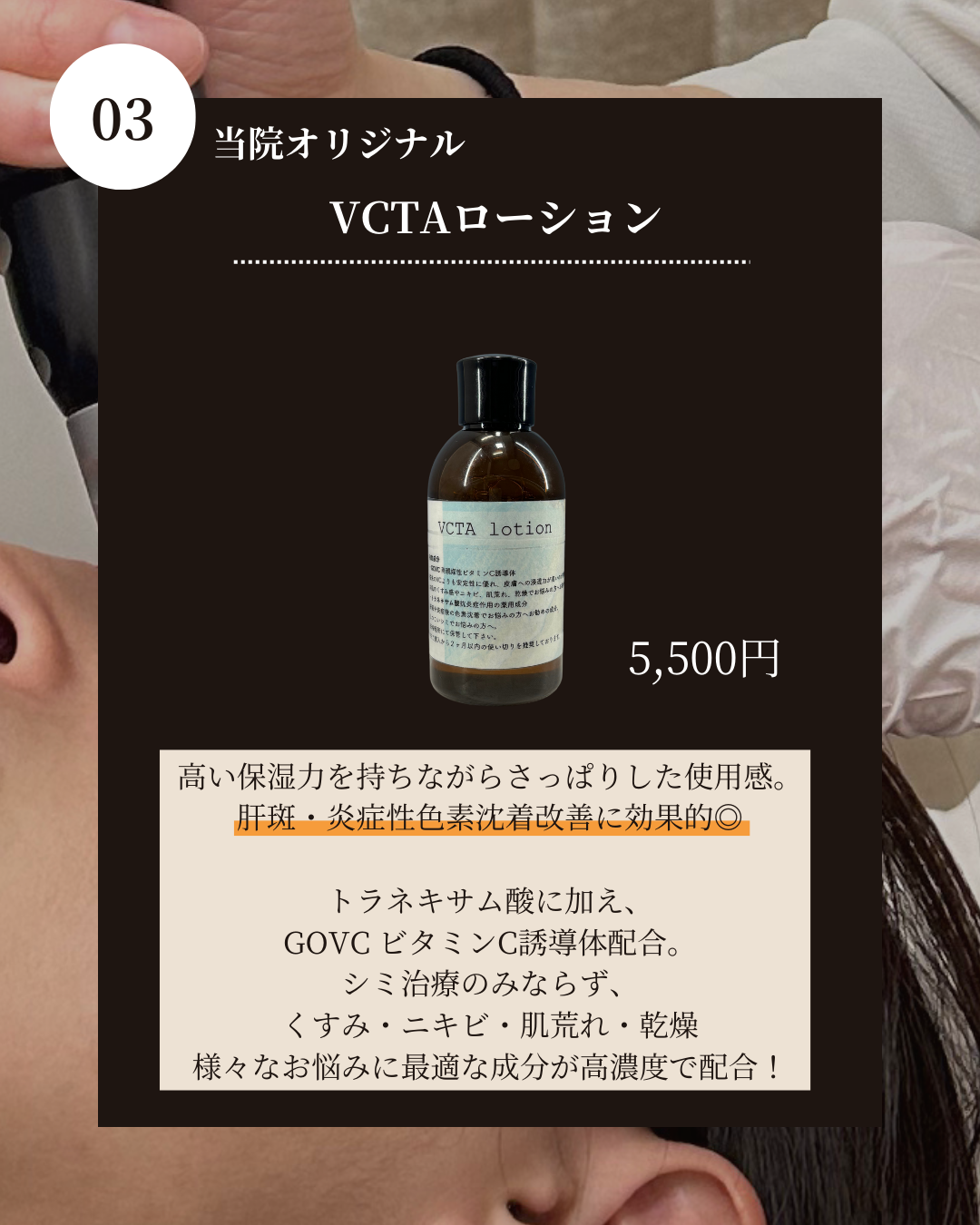 トラネキサム 酸 化粧 水