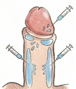 強化プランのイメージ図