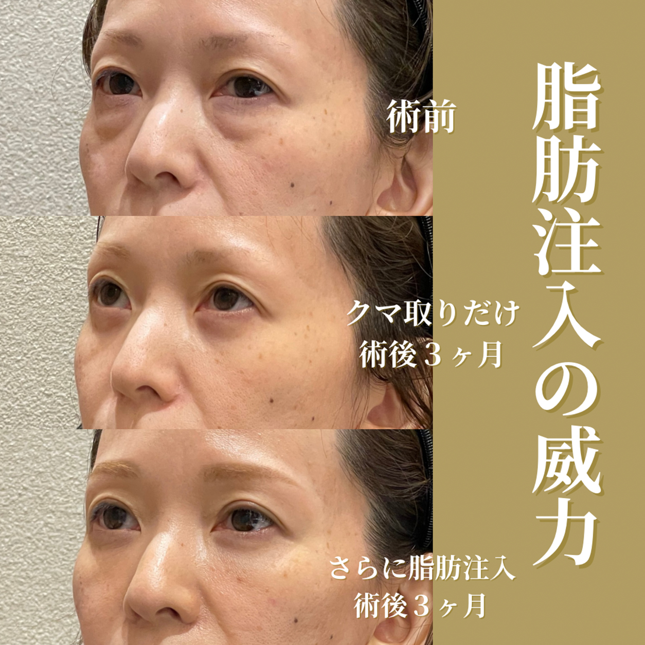 症例