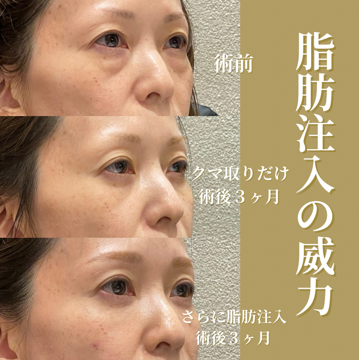 症例