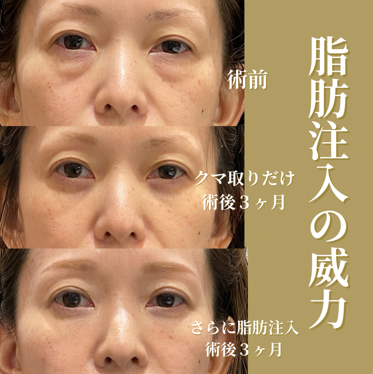 症例