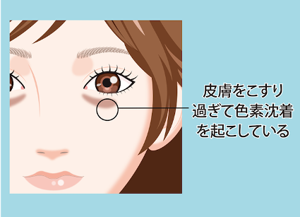 クマの種類