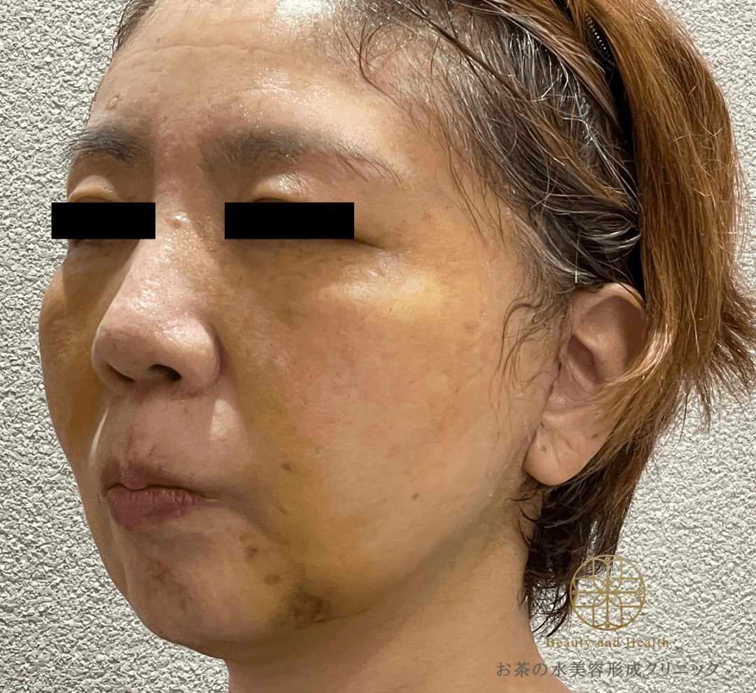 Case1