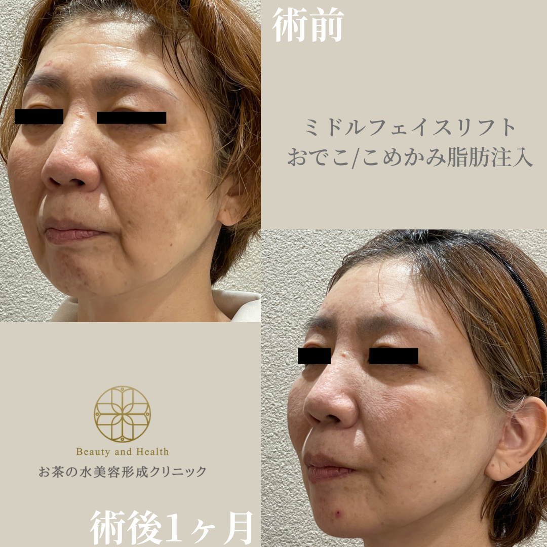 Case1