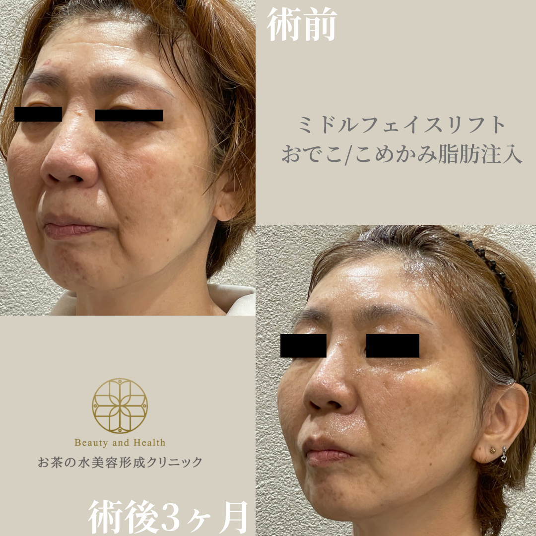 Case1