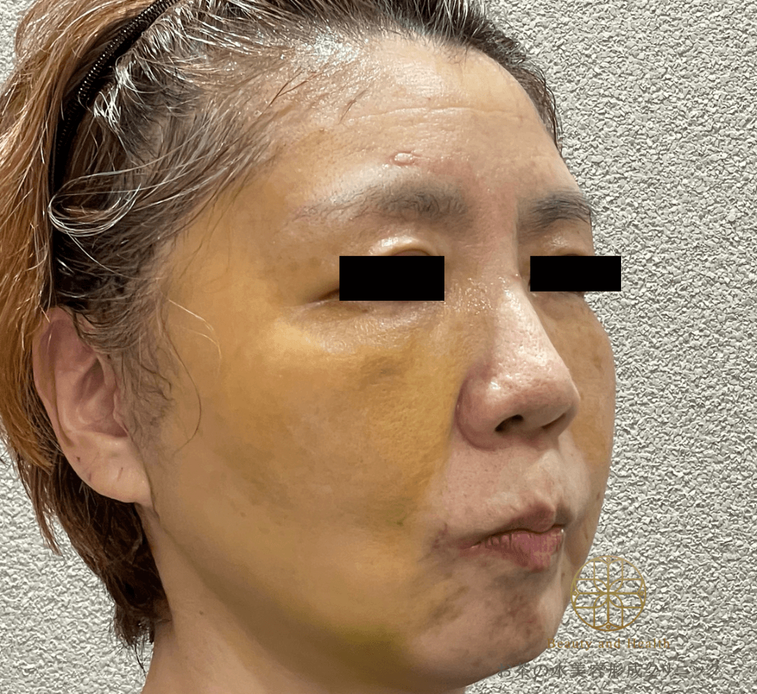 Case1