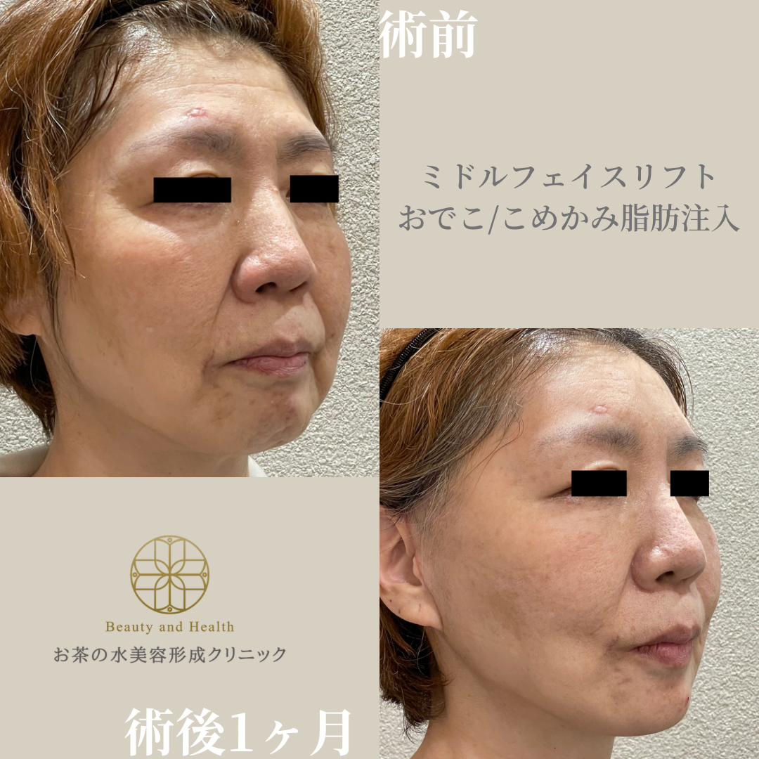 Case1