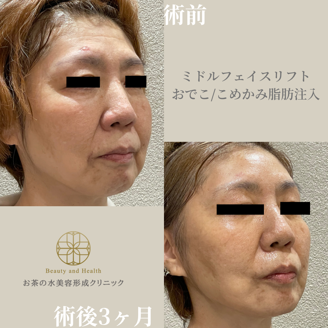 Case1