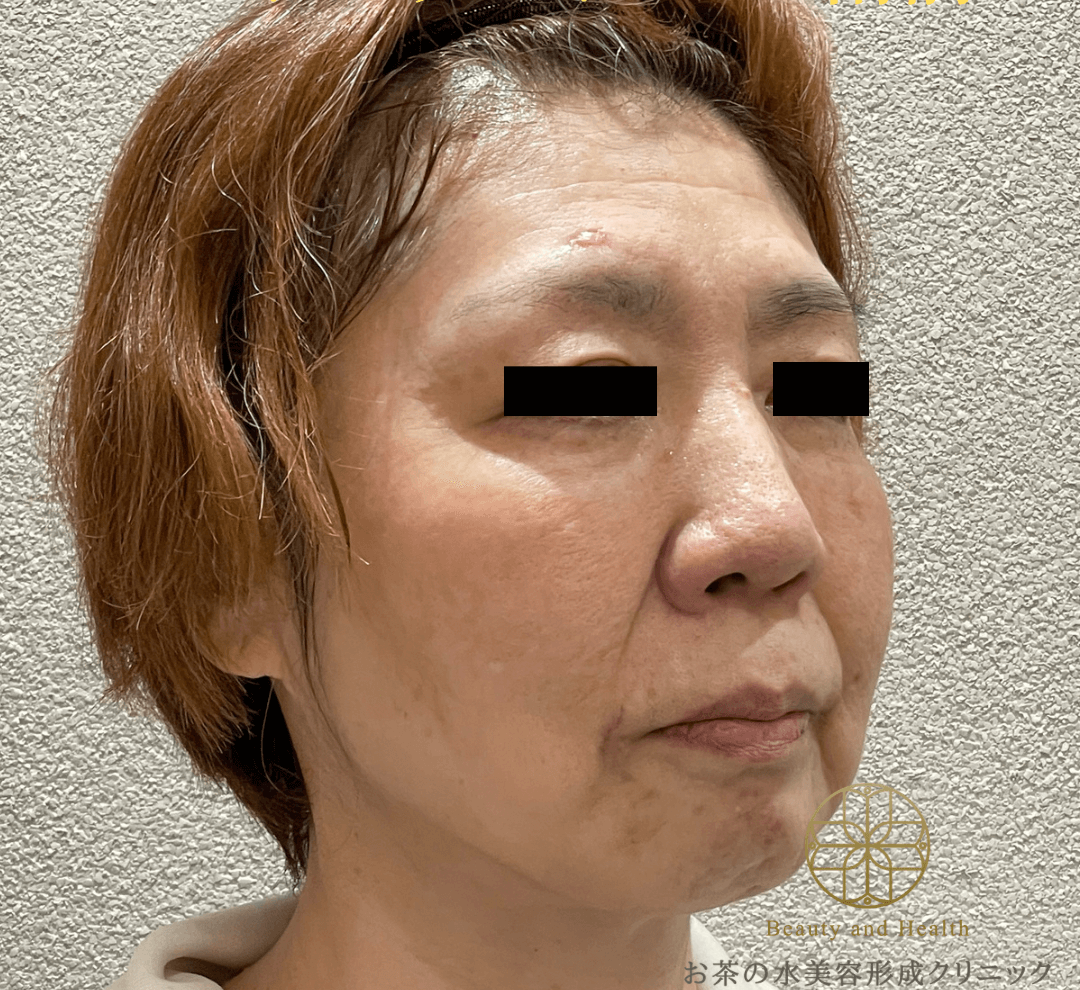 Case1