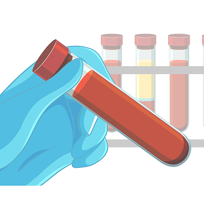 パイプカットとは