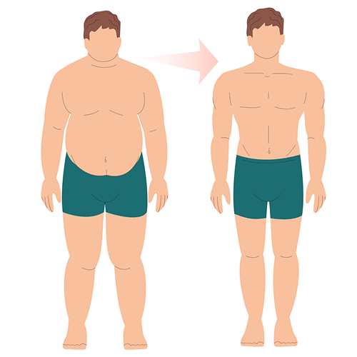 メディカルダイエット・脂肪吸引
