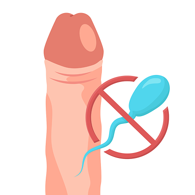 パイプカットとは