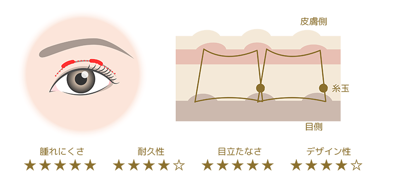 シングルスクエア