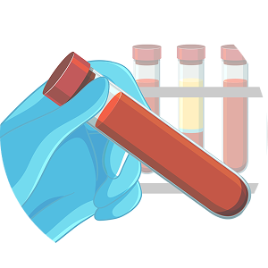 血液検査（HIV・HBV・HCV）の重要性