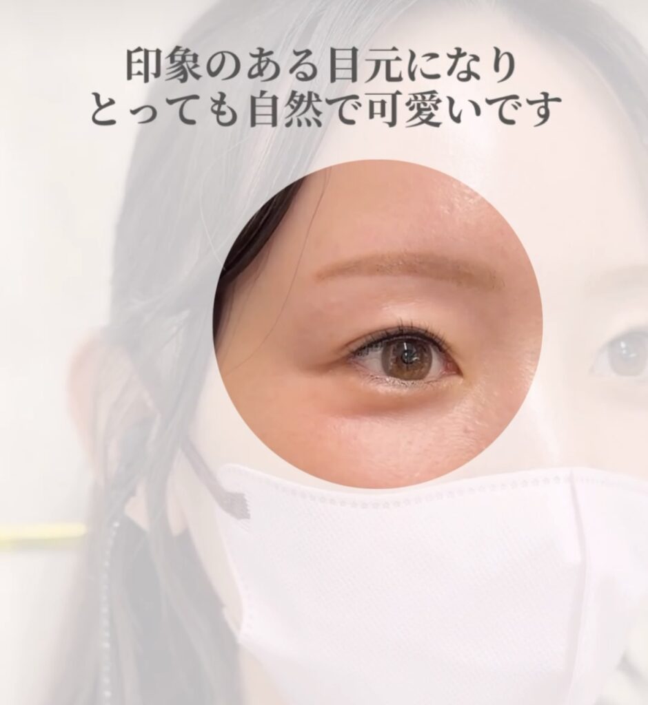 印象のある目元になりとっても自然で可愛いです。