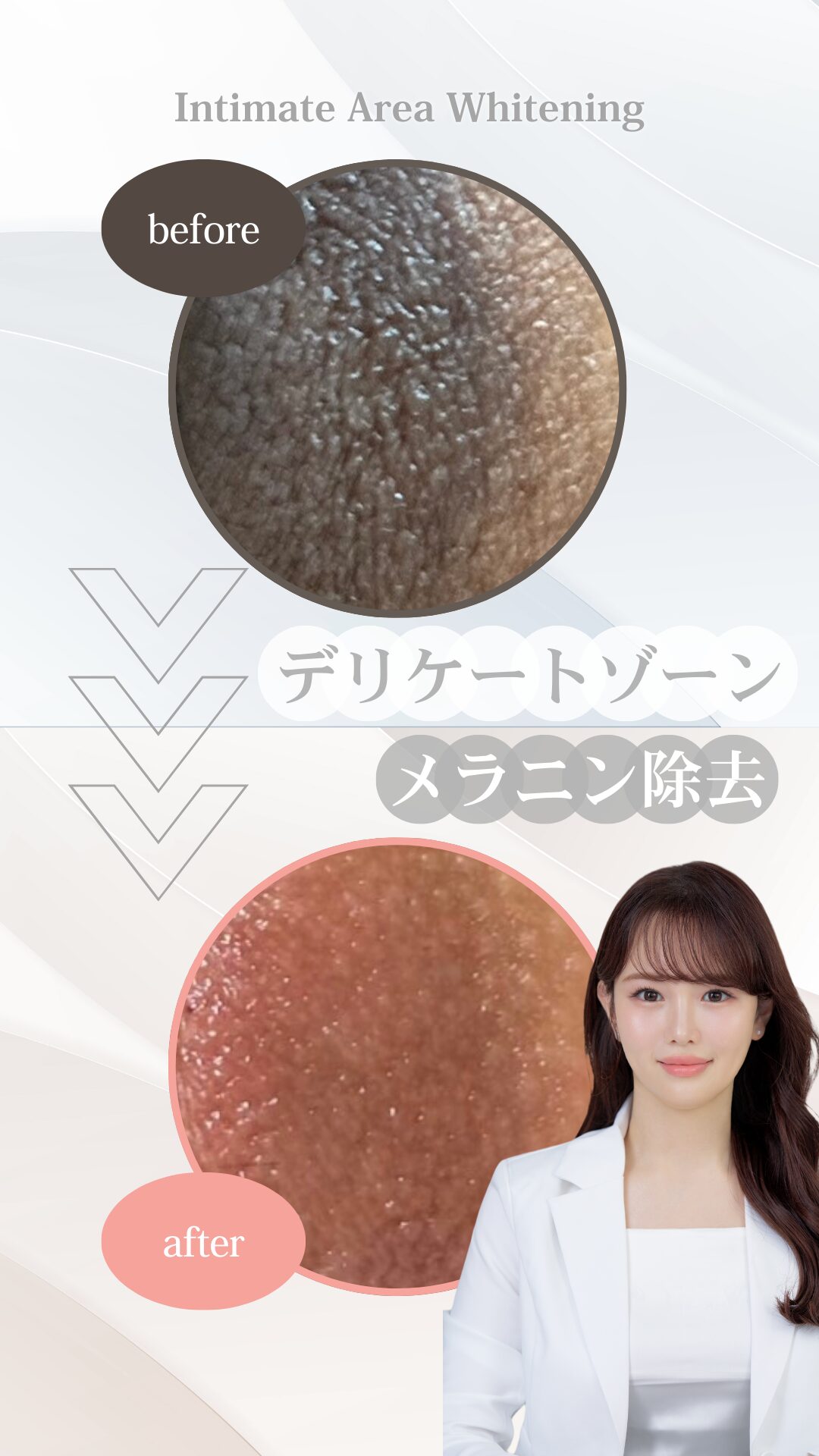 ROMA PINK デリケートゾーンのくすみケア