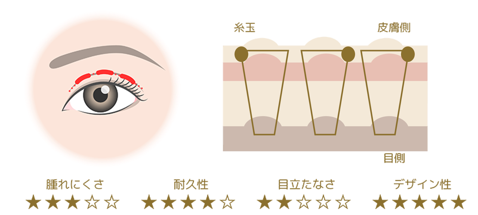 シングルスクエア