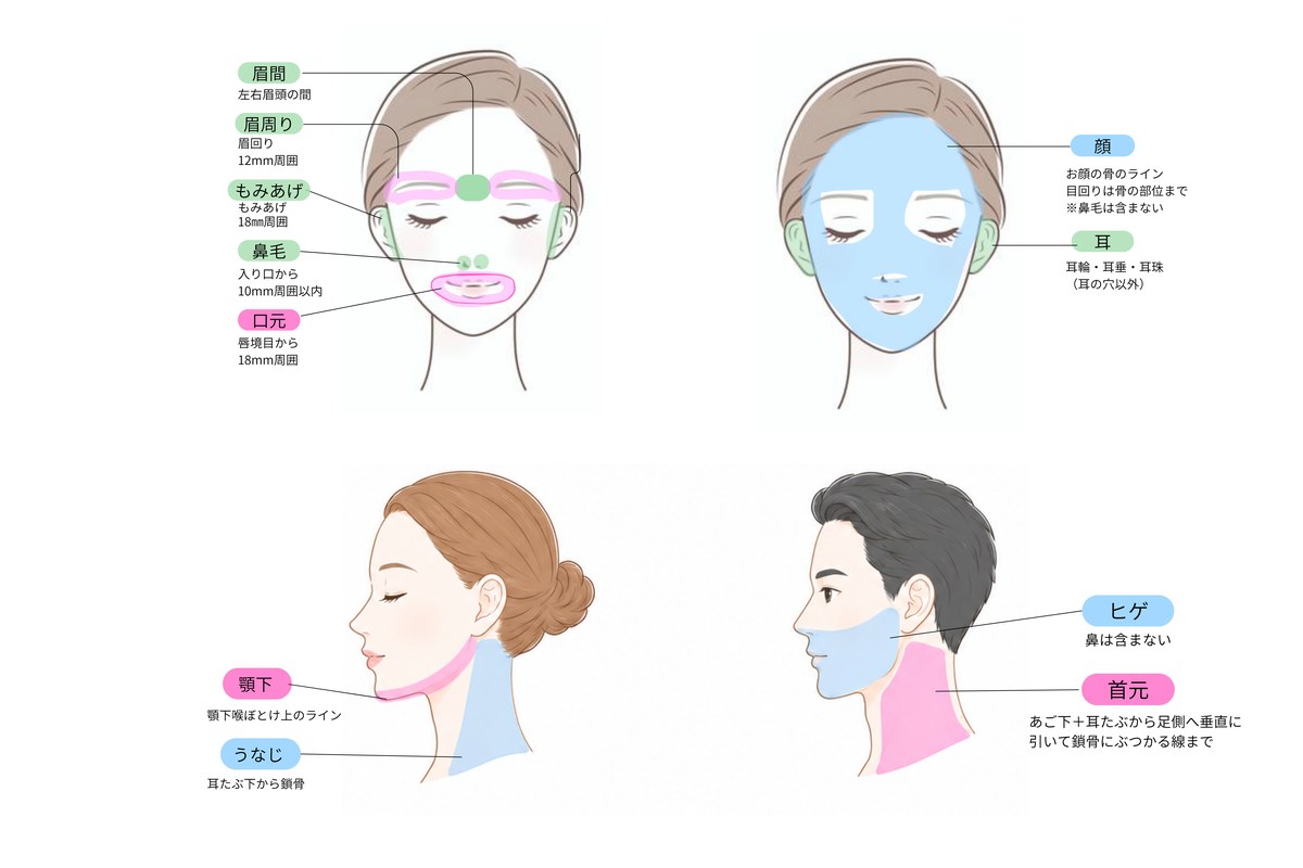 医療脱毛の範囲を表す図　顔
