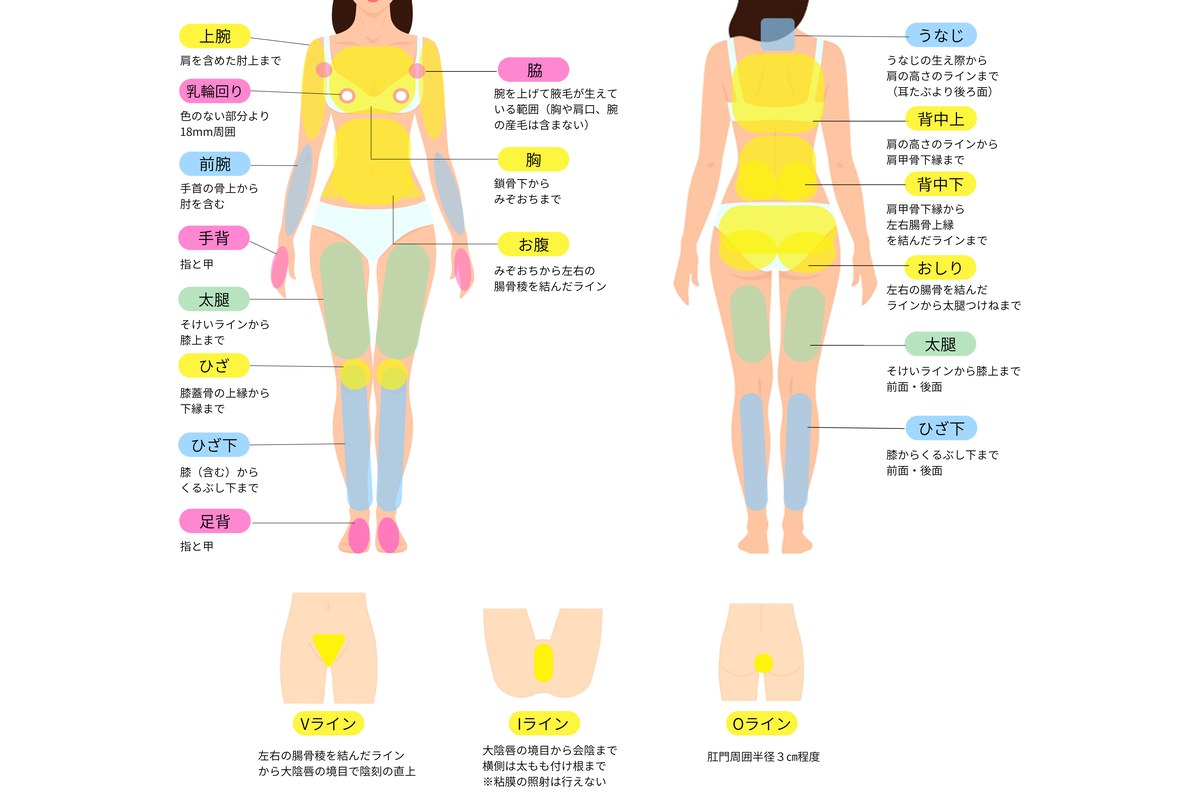 医療脱毛の対象部位を表す図 全身 VIO
