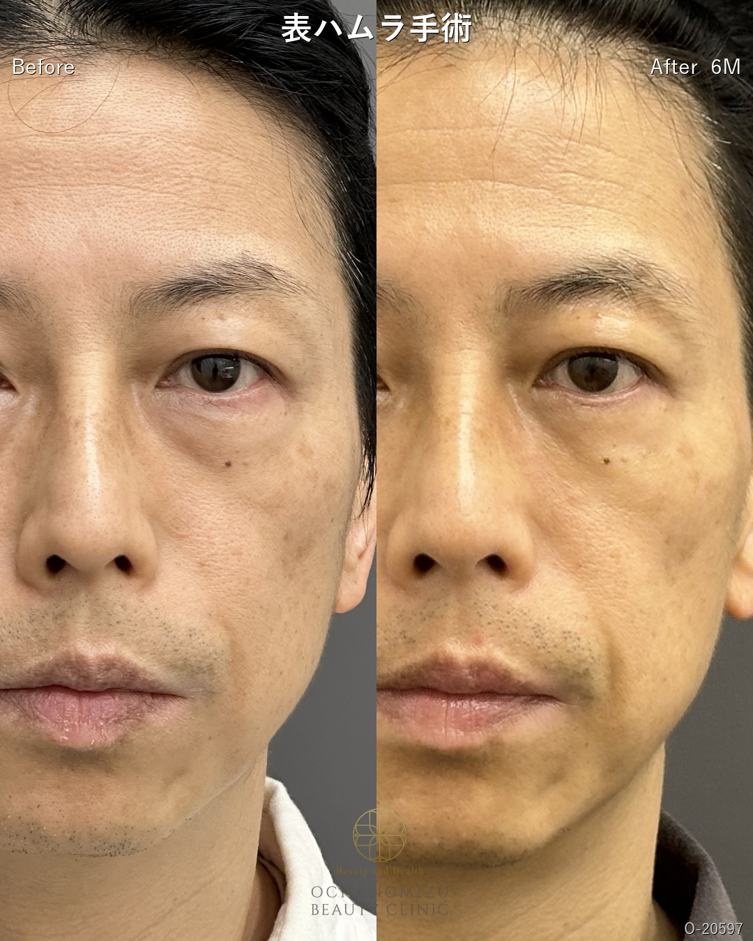 表ハムラ