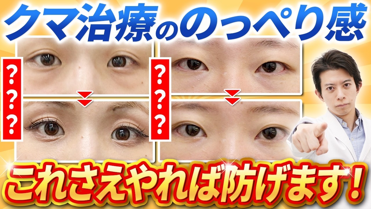 目の下のクマ治療「裏ハムラ法」と「脱脂＋脂肪注入」の適切な選択｜吉井統括医師が解説