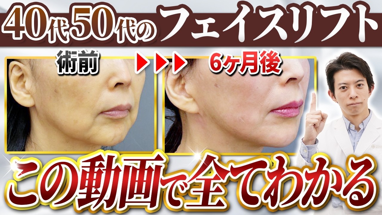 お茶の水美容形成クリニックが解説！フェイスリフトの種類と効果