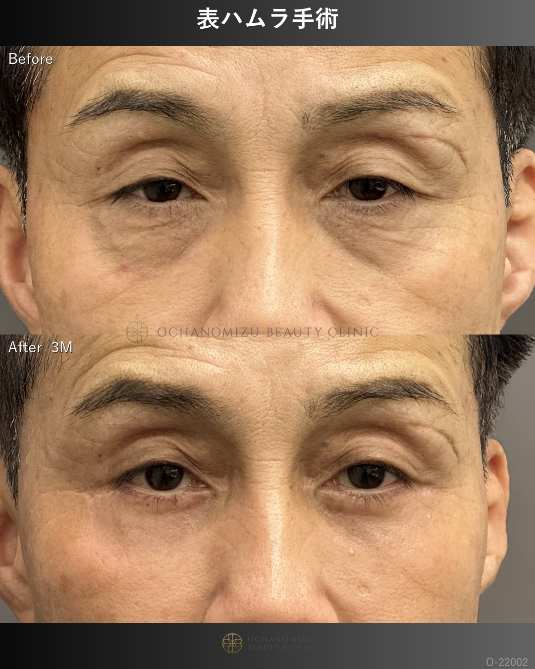 表ハムラ