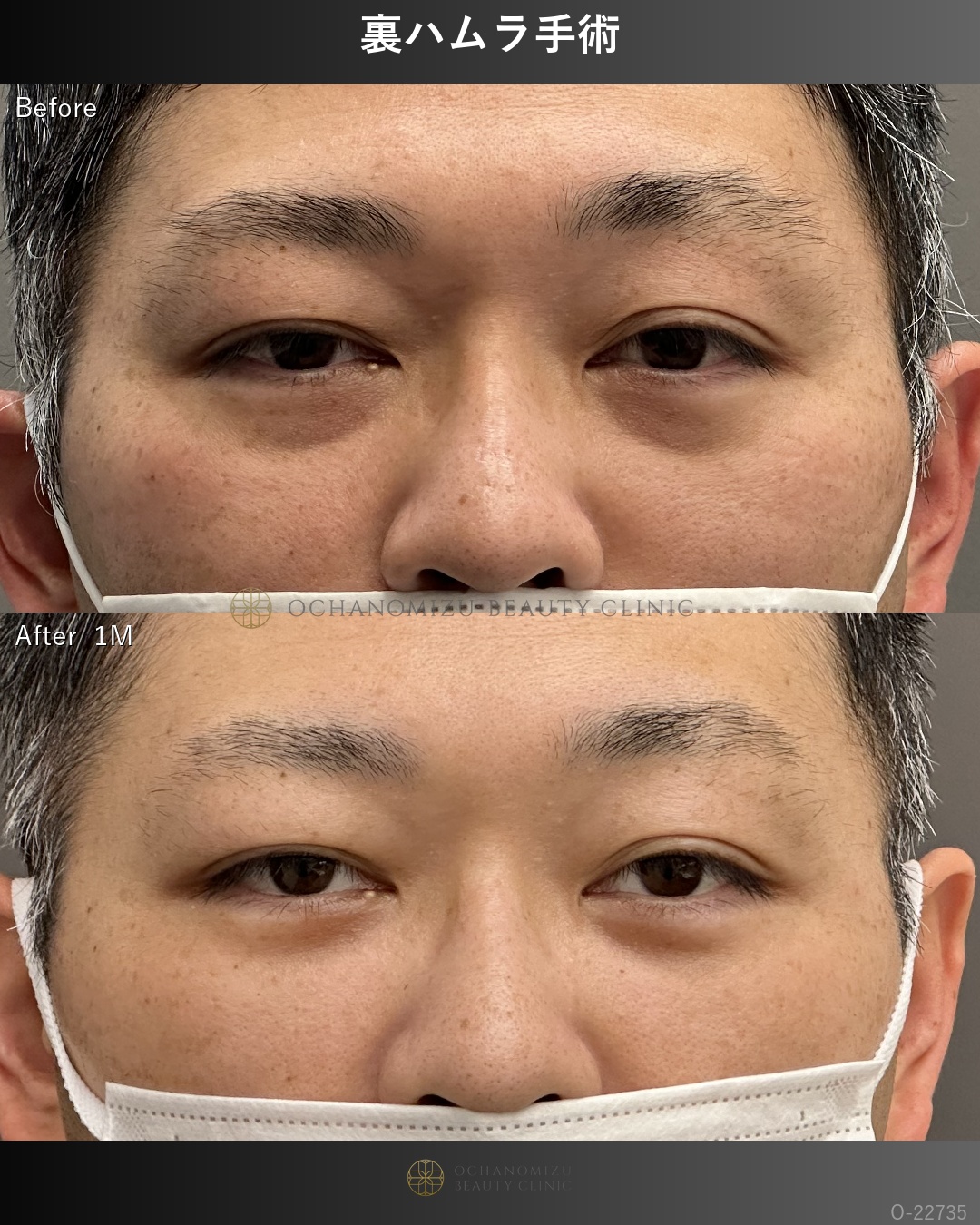 裏ハムラ