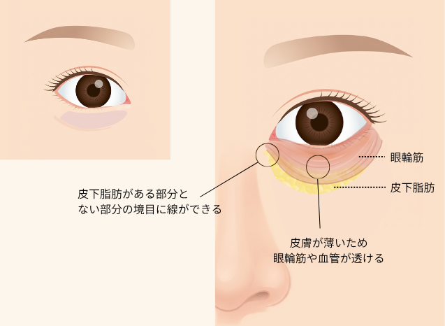 青クマのしくみ｜皮膚が薄いため眼輪筋や血管が透けて見え、皮下脂肪の境目に線ができる図