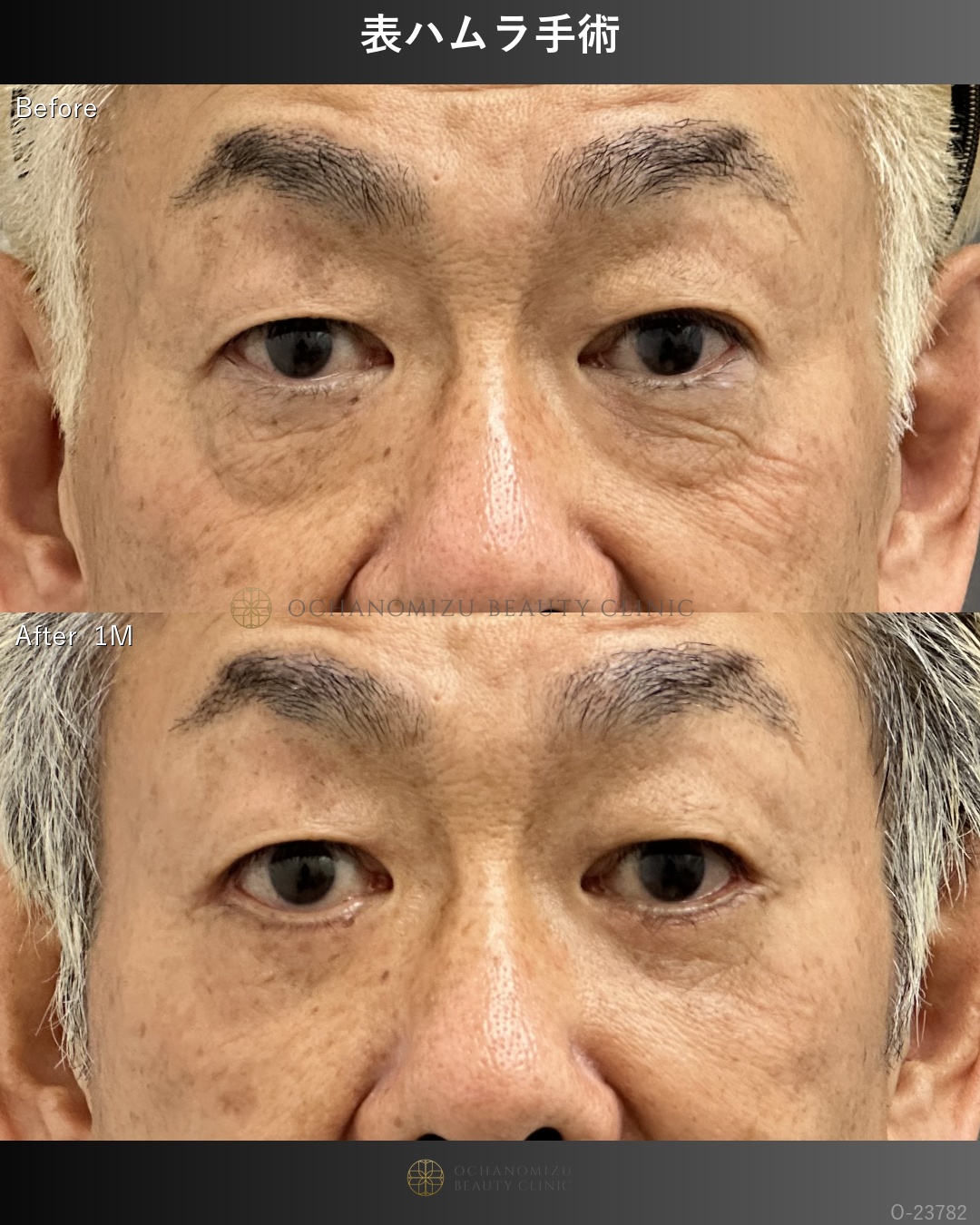 表ハムラ