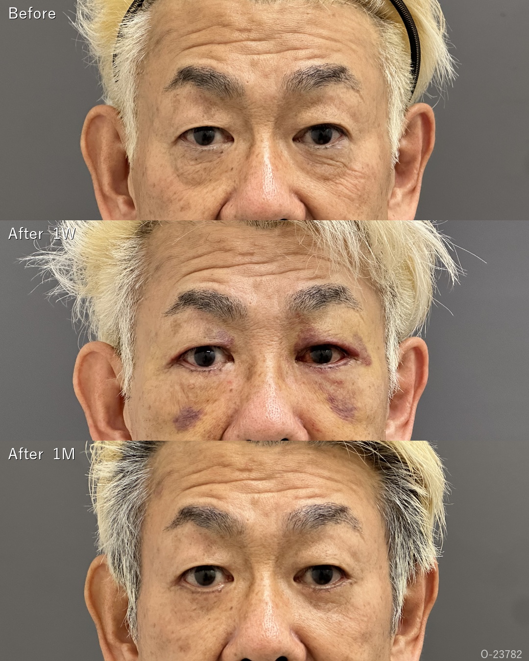表ハムラ