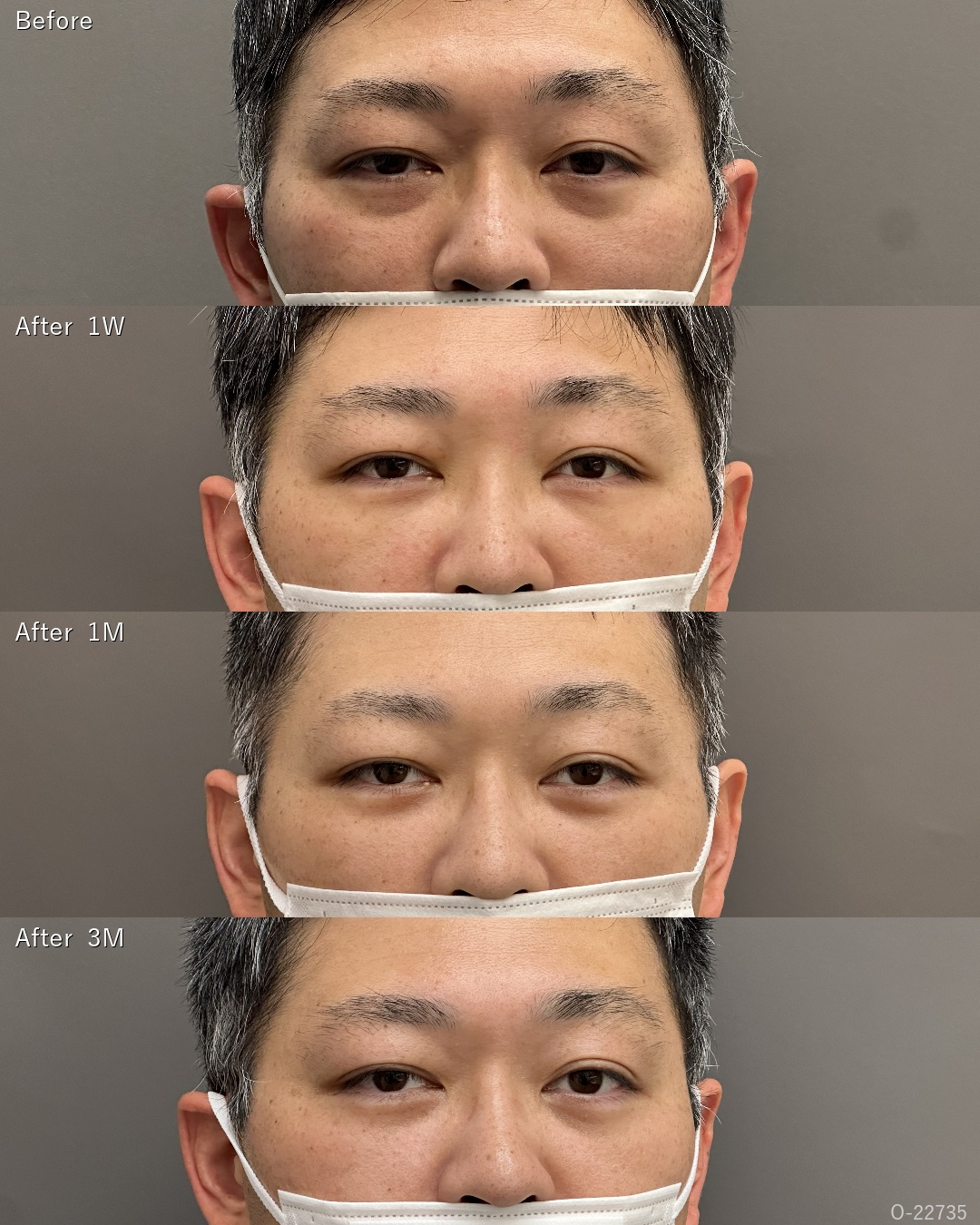 裏ハムラ