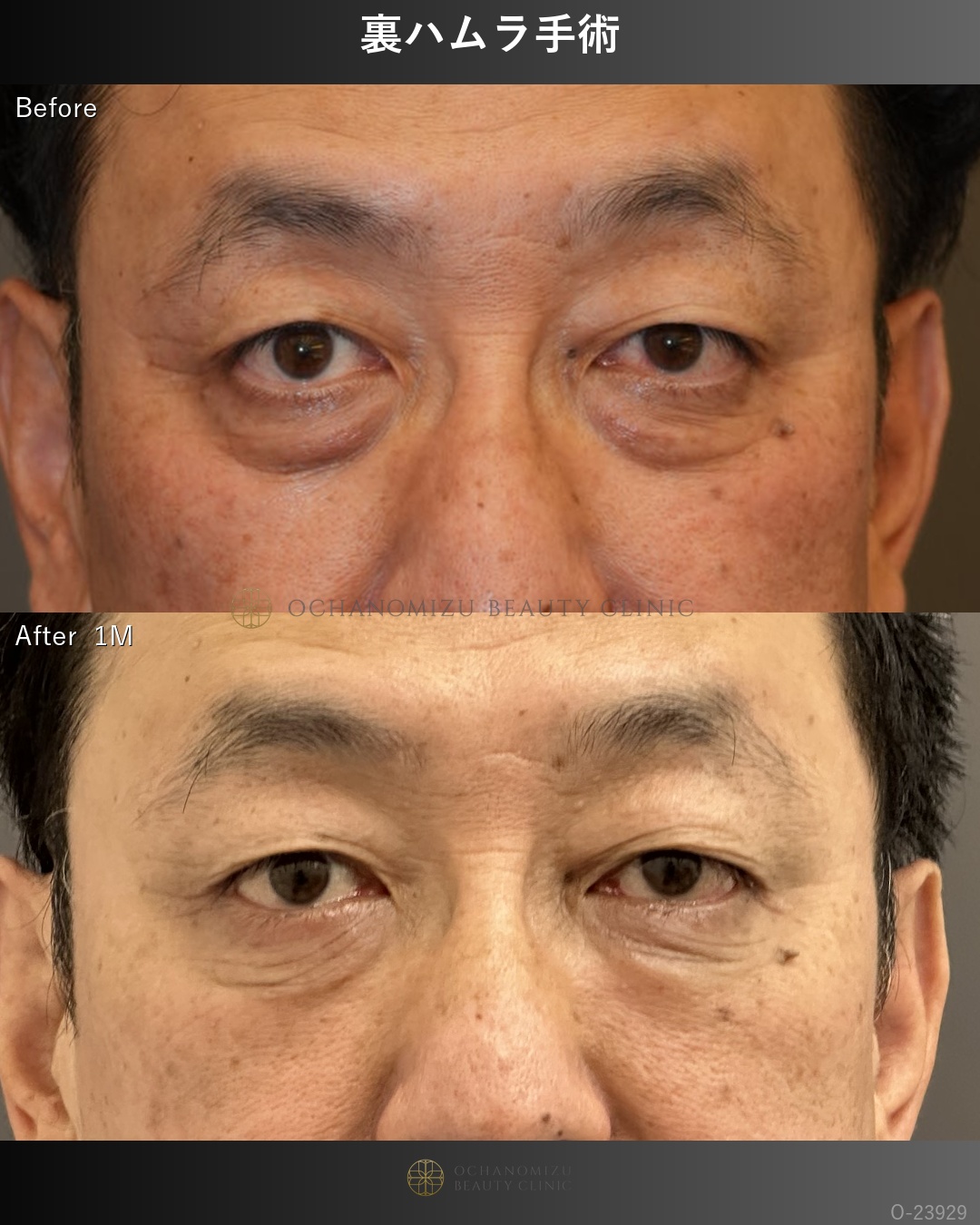 裏ハムラ