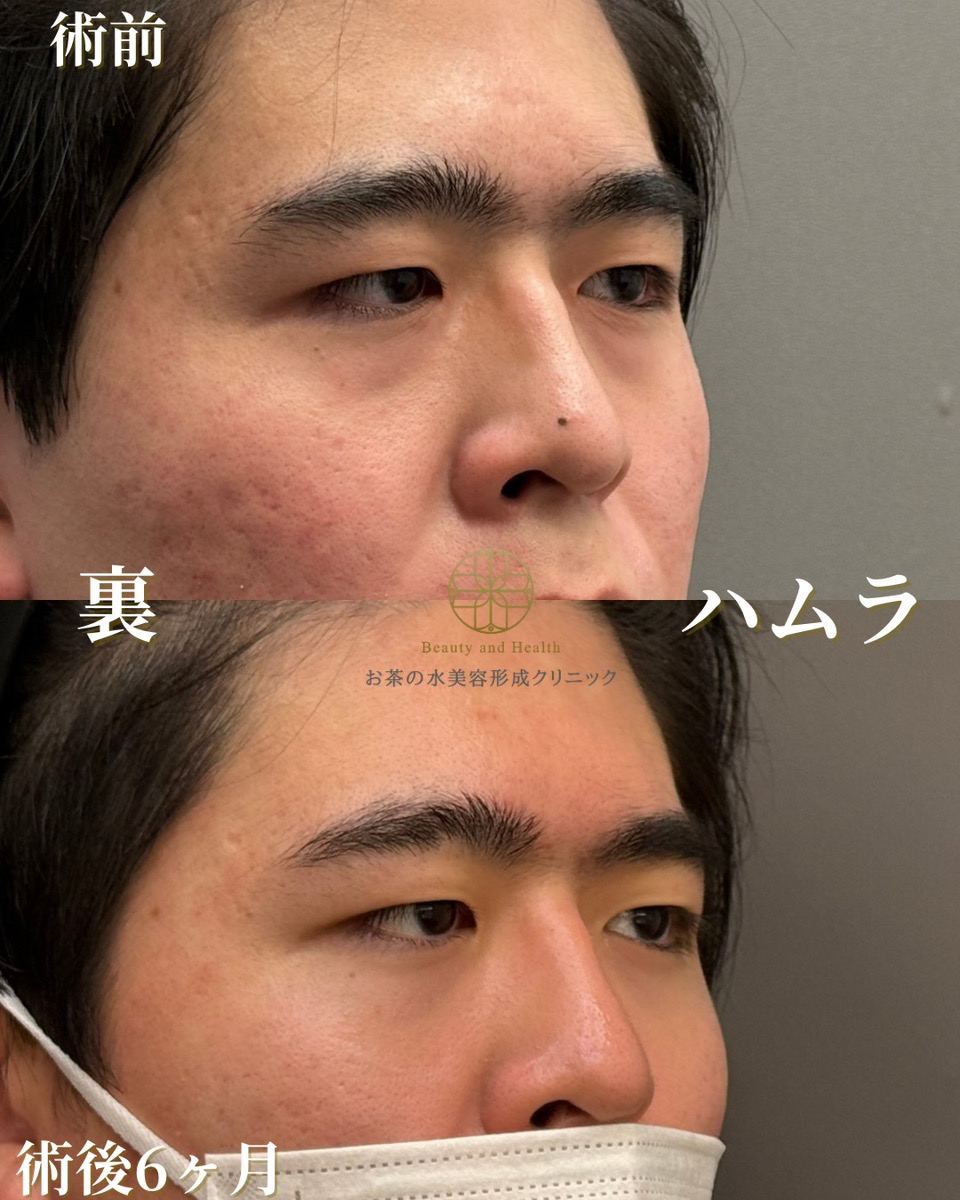 裏ハムラ
