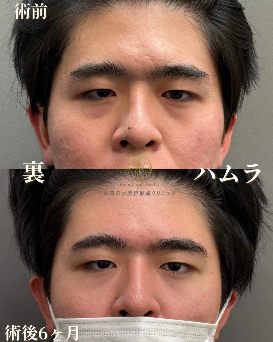 裏ハムラ