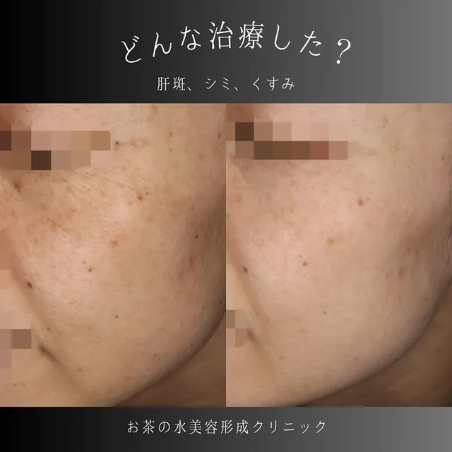 男性の肌治療
