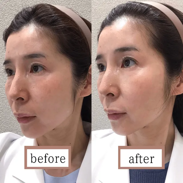 プロファイロ