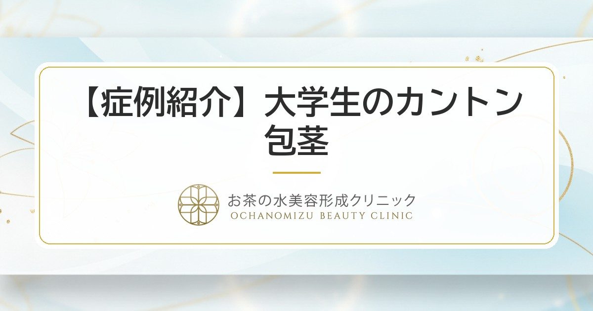 【症例紹介】大学生のカントン包茎｜泌尿器科クリニックからのご紹介で亀頭直下埋没法