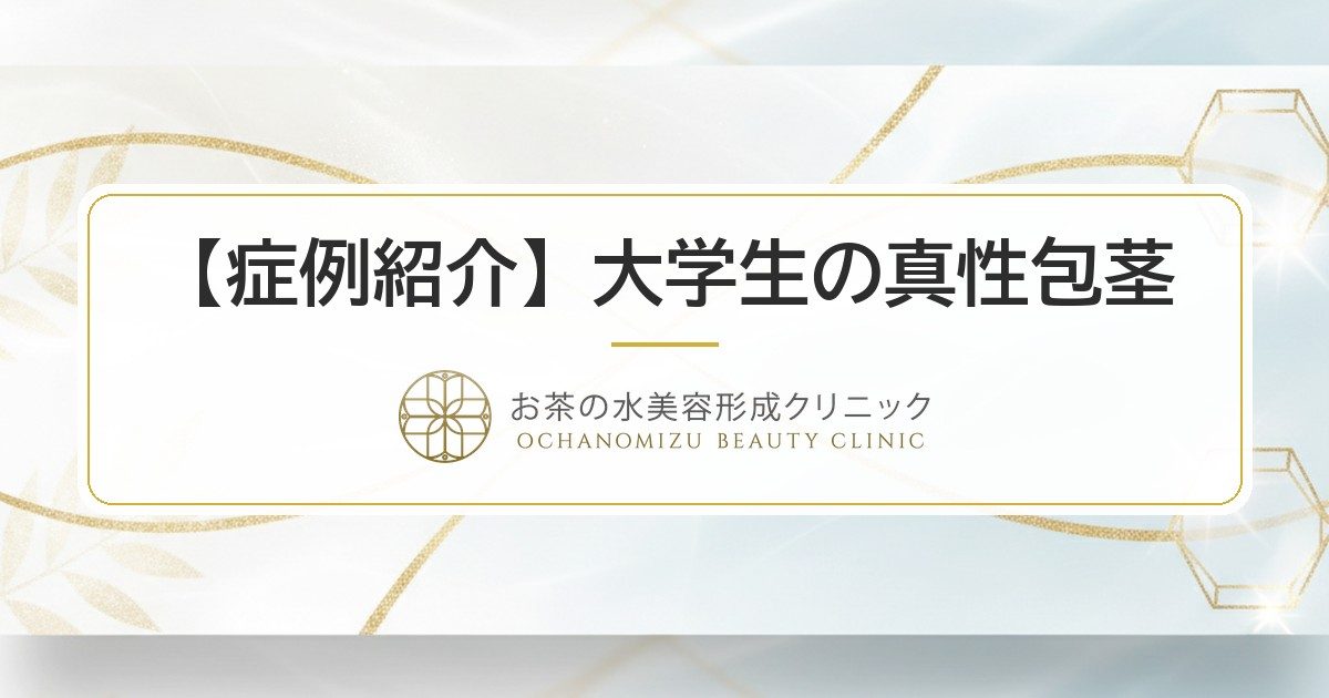 【症例紹介】大学生の真性包茎｜機能と見た目を両立する包茎治療