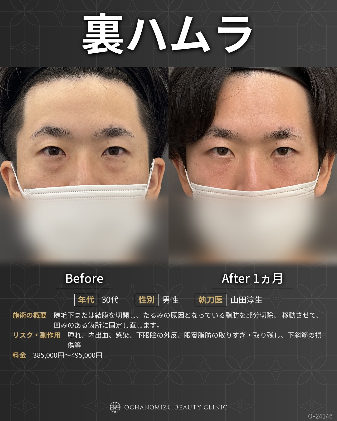 裏ハムラ