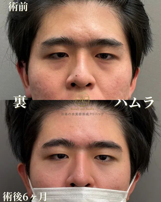裏ハムラ